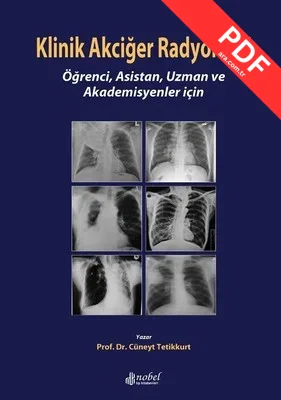 Klinik Akciğer Radyolojisi kitap kapağı