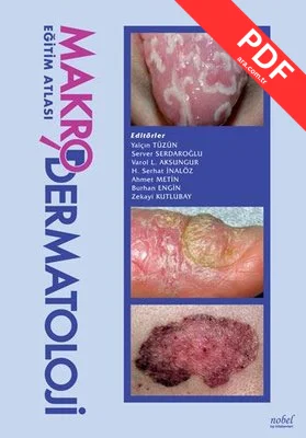 Makrodermatoloji Eğitim Atlası kitap kapağı