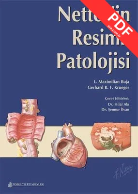 Netter'İn Resimli Patolojisi kitap kapağı